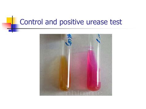 salmonella urease test|Iba pa.